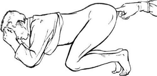 Правила проведення масажу простати